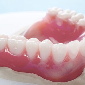Prótese Total Idental
